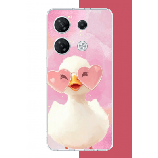Infinix GT 20 PRO Uyumlu gözlüklü yavru ördek UV Baskılı Silikon Kılıf