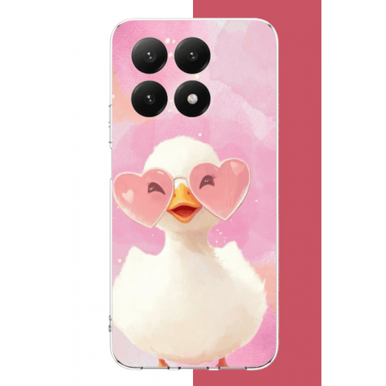 Xiaomi Mi 15T Uyumlu gözlüklü yavru ördek UV Baskılı Silikon Kılıf