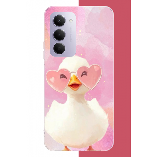 Redmi 15 4G Uyumlu gözlüklü yavru ördek UV Baskılı Silikon Kılıf