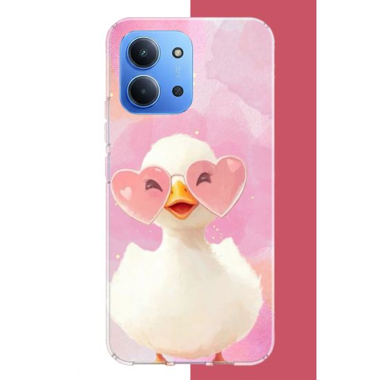 Redmi 15C Uyumlu gözlüklü yavru ördek UV Baskılı Silikon Kılıf