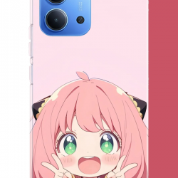 Redmi 15C Uyumlu kawaii küçük kız2 UV Baskılı Silikon Kılıf